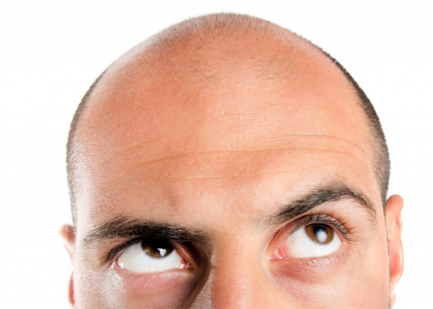 Wypadanie włosów u mężczyzn + test Vichy Dercos Neogenic